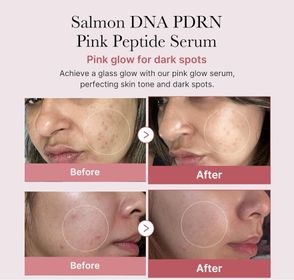 Collagen PDRN Pink Peptide Serum 30ml