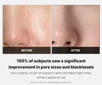 Zero Pore Pad 2.0 (70ea)